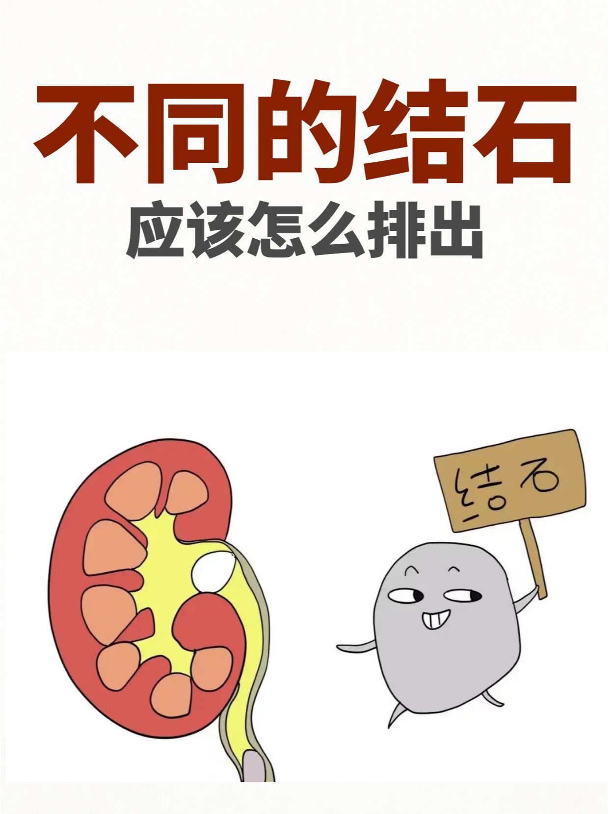 71明明自己的结石比别人小,喝的水不比别人少,运动也起的比别人早.