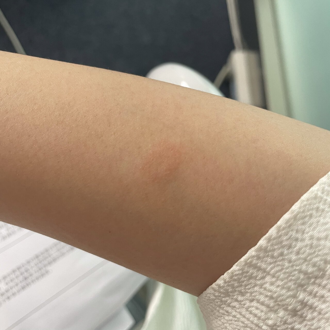 这是跳蚤还是螨虫咬的?