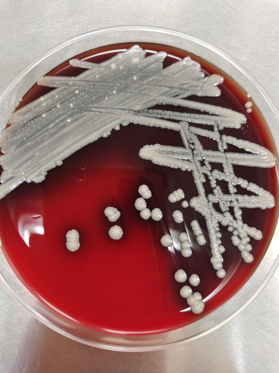 医学检验微生物,纹带棒杆菌     痰液标本,上图为放置了72h的菌落形态