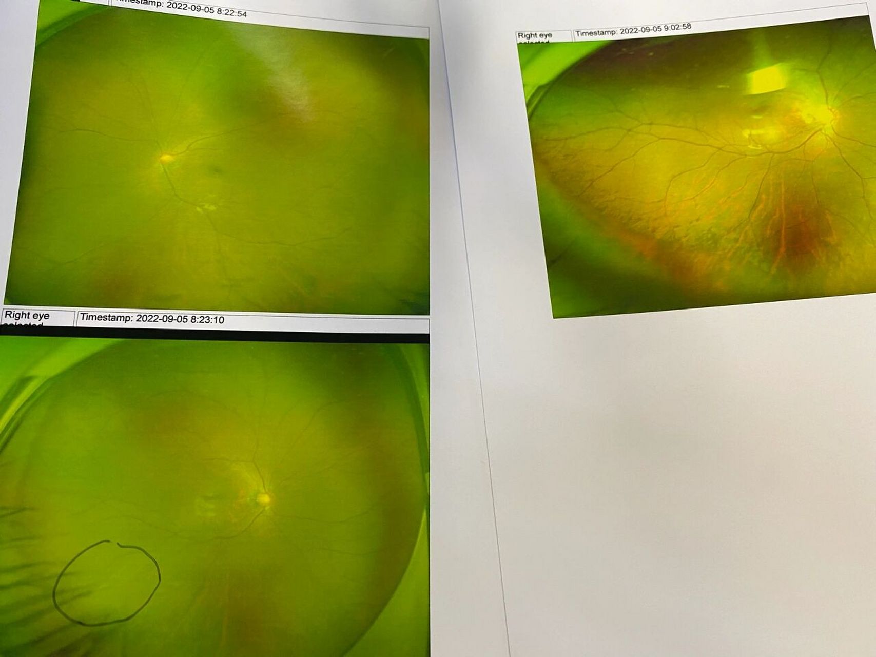 浙二眼科常规检查攻略及费用表99!