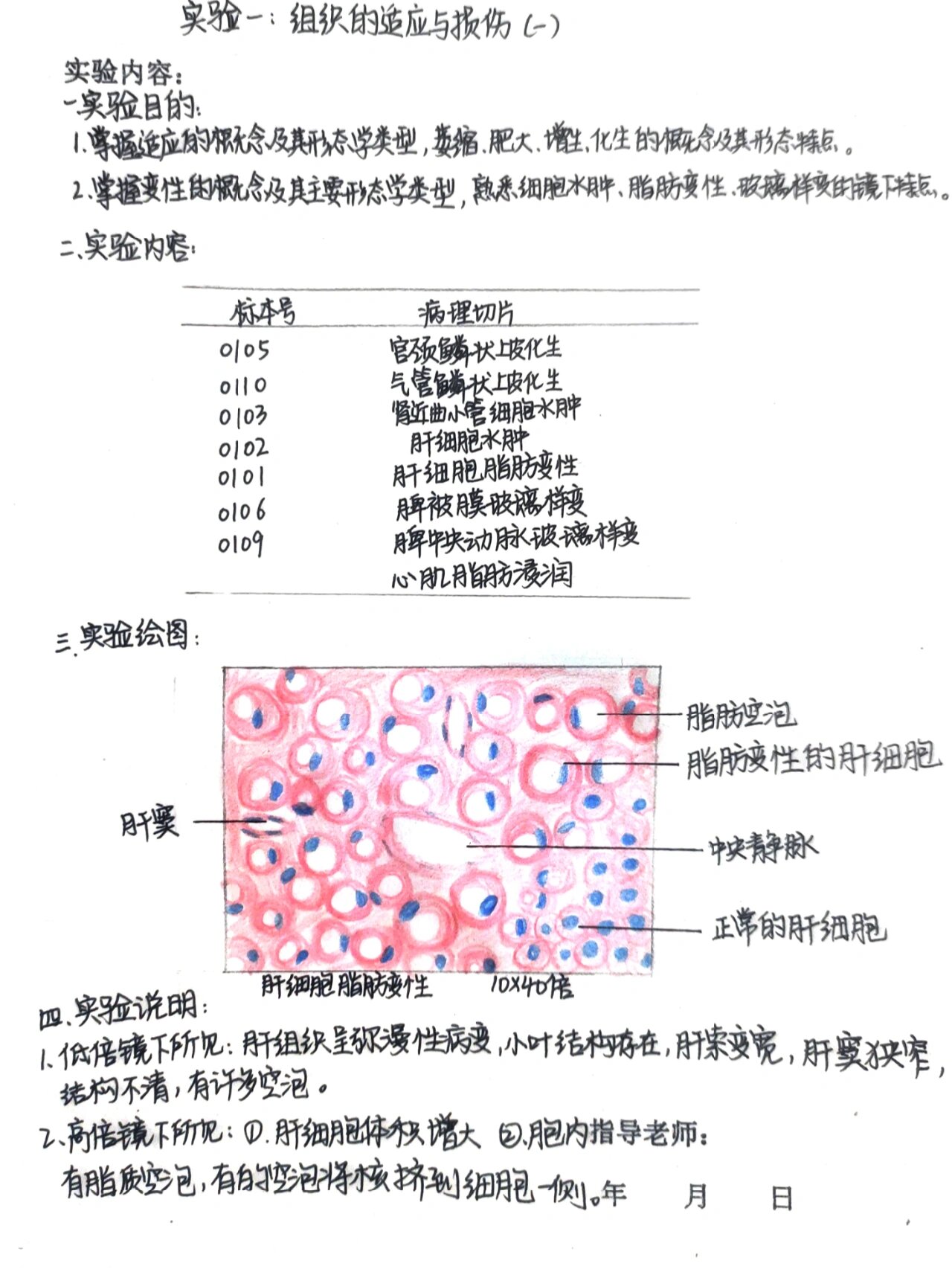 肝硬化手绘图实验报告图片