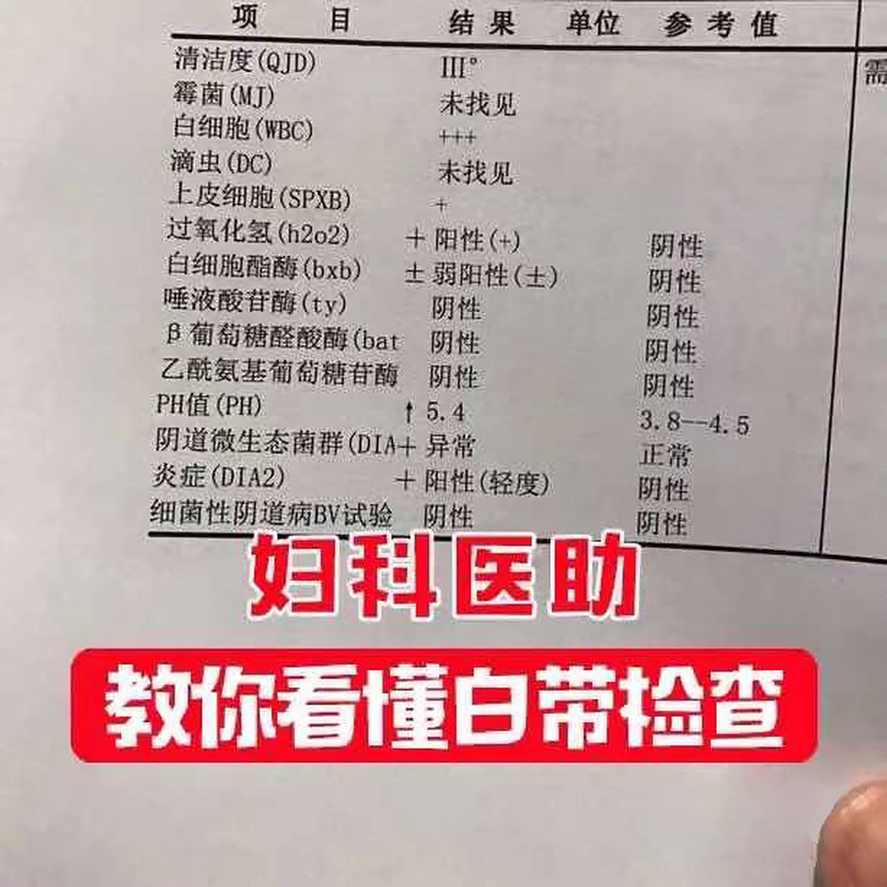 教你一分钟看懂检查报告 白带常规是女性妇科检查的基本项目,但是每个