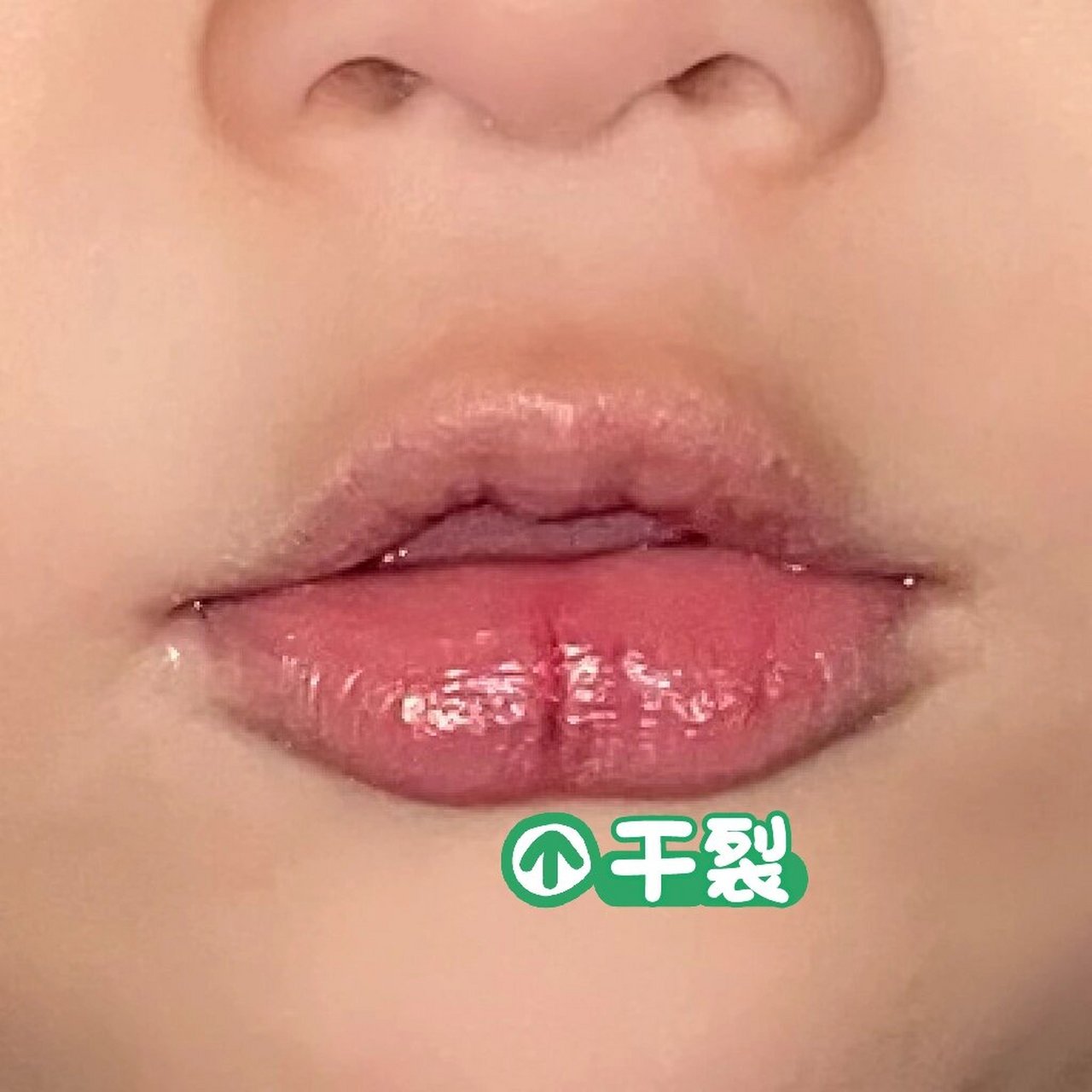 宝宝嘴唇干裂怎么办?