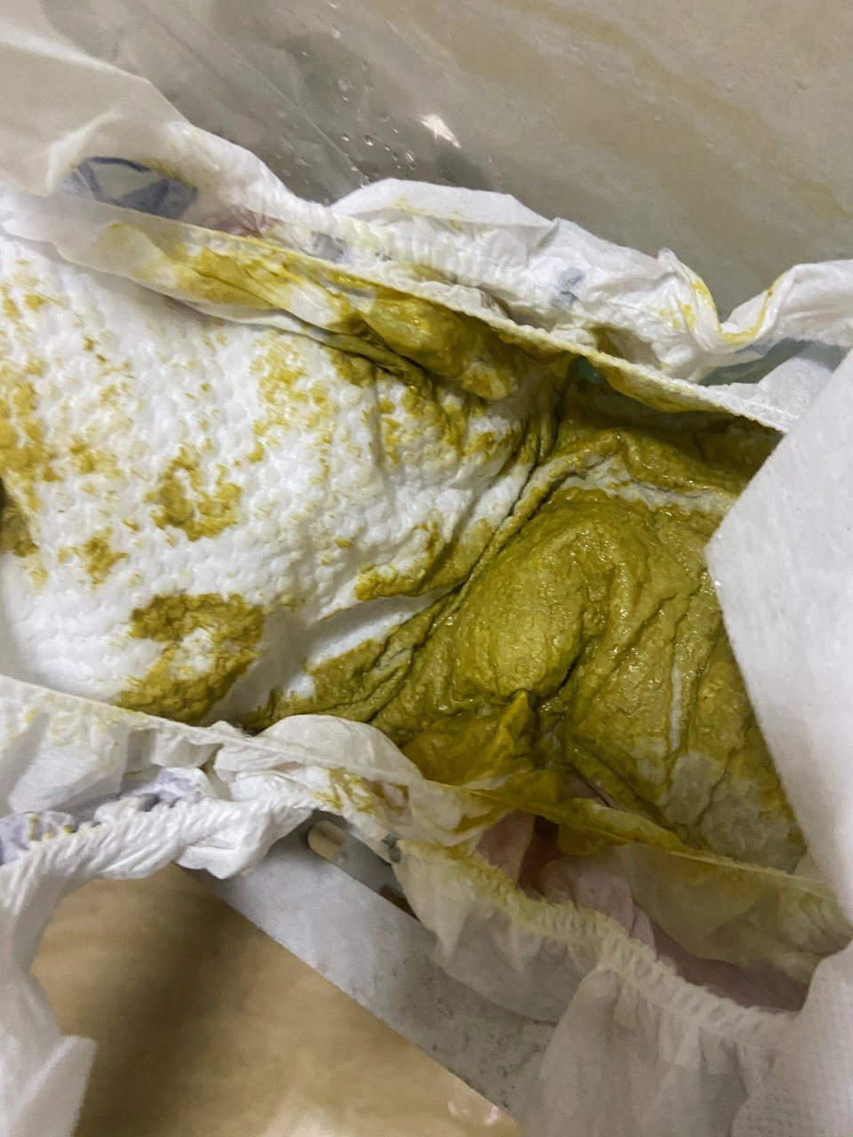 便便粘液,稀,奶瓣调理 昨天的便便跟今天的便便对比图 有没有改善如图