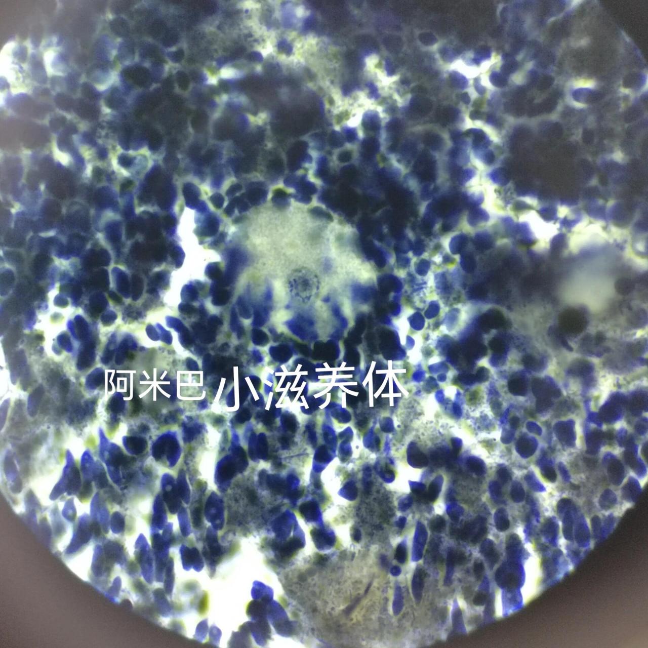 阿米巴滋养体 寄生虫学——溶组织阿米巴滋养体和包囊