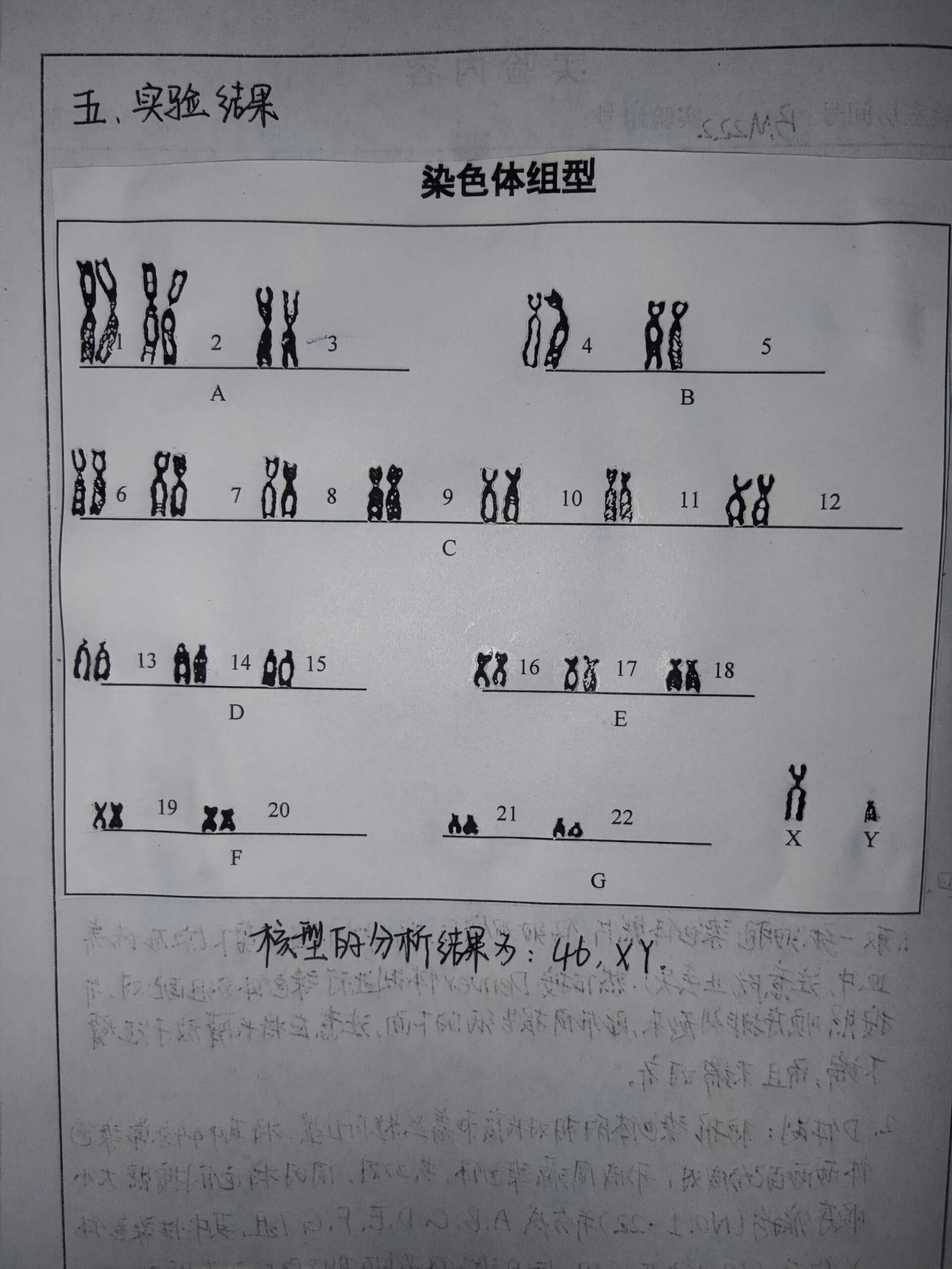 人类的染色体核型分析