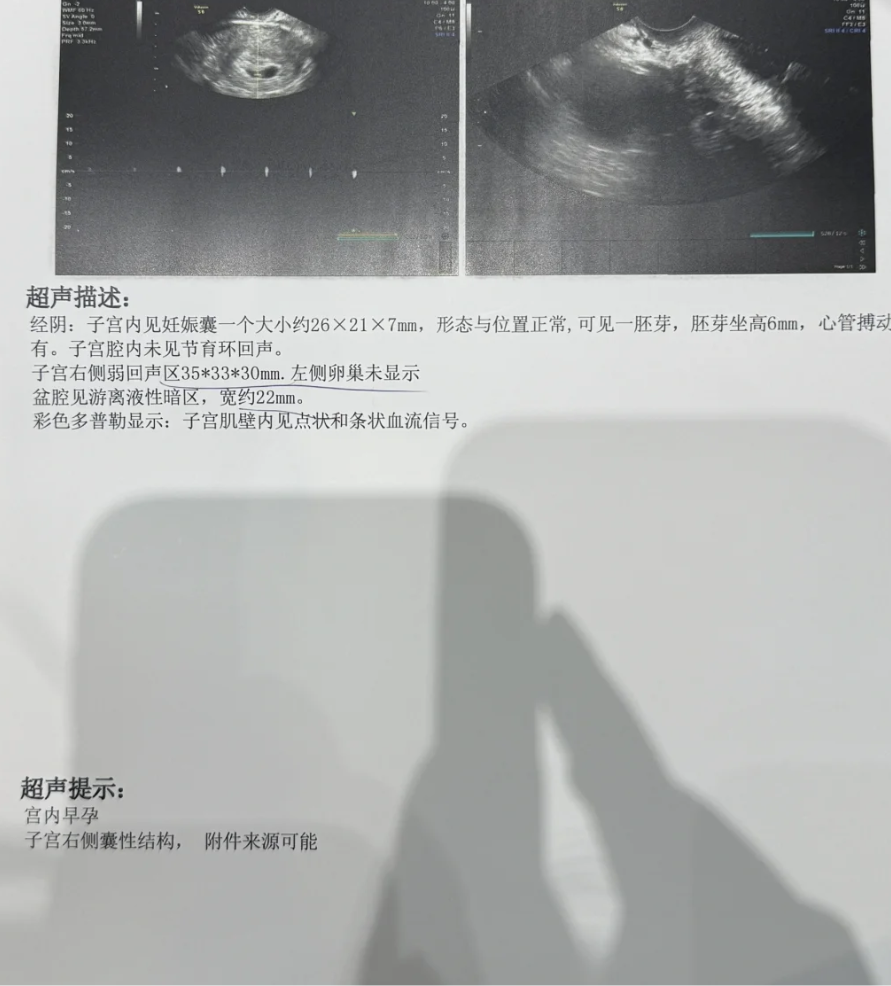 📟2025年正常人吃米索前列醇会怎样(最新分享米索前列醇片吃一粒有效果吗信息)