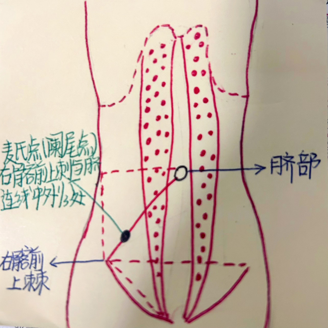 麦氏点图片