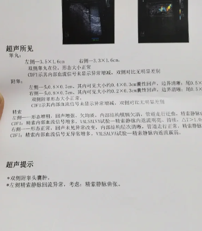 精索静脉曲张2.5mm不算严重,属于轻度范围.根据超声分度标准,2