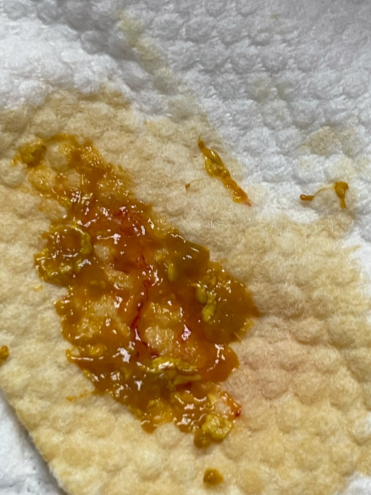 过敏宝宝,坚持母乳,内有大便图(1) 历时8个月,终