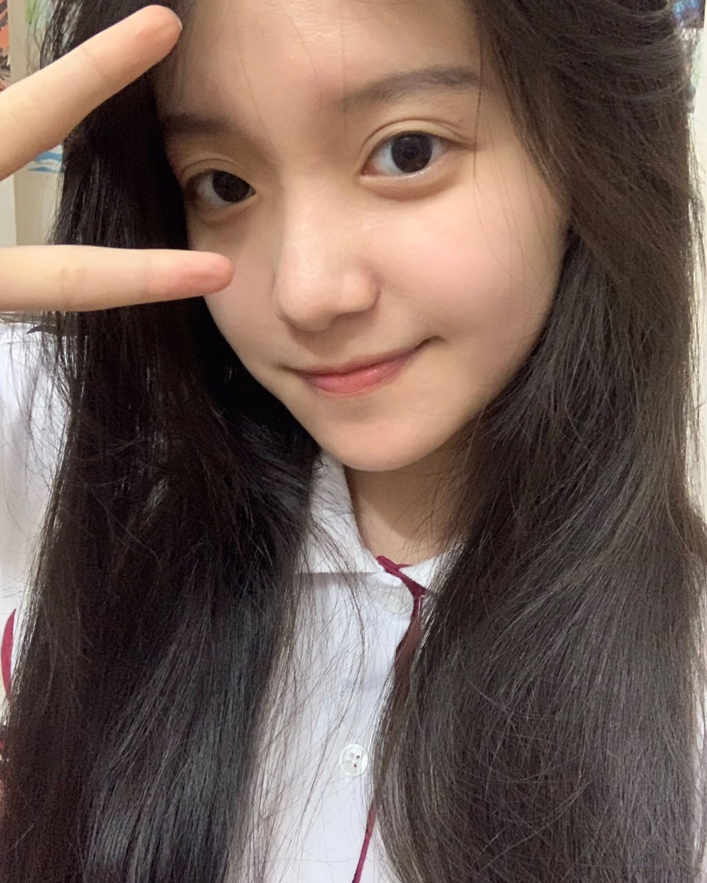 05|17岁的素颜就是我最美的妆容! 最近额头长痘痘了 那又怎么样!