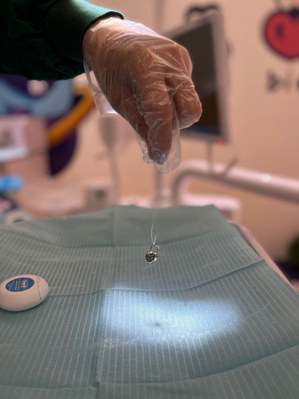 第二乳磨牙也是大面积龋损,于是就把金属预成冠和间隙保持器合体,让它