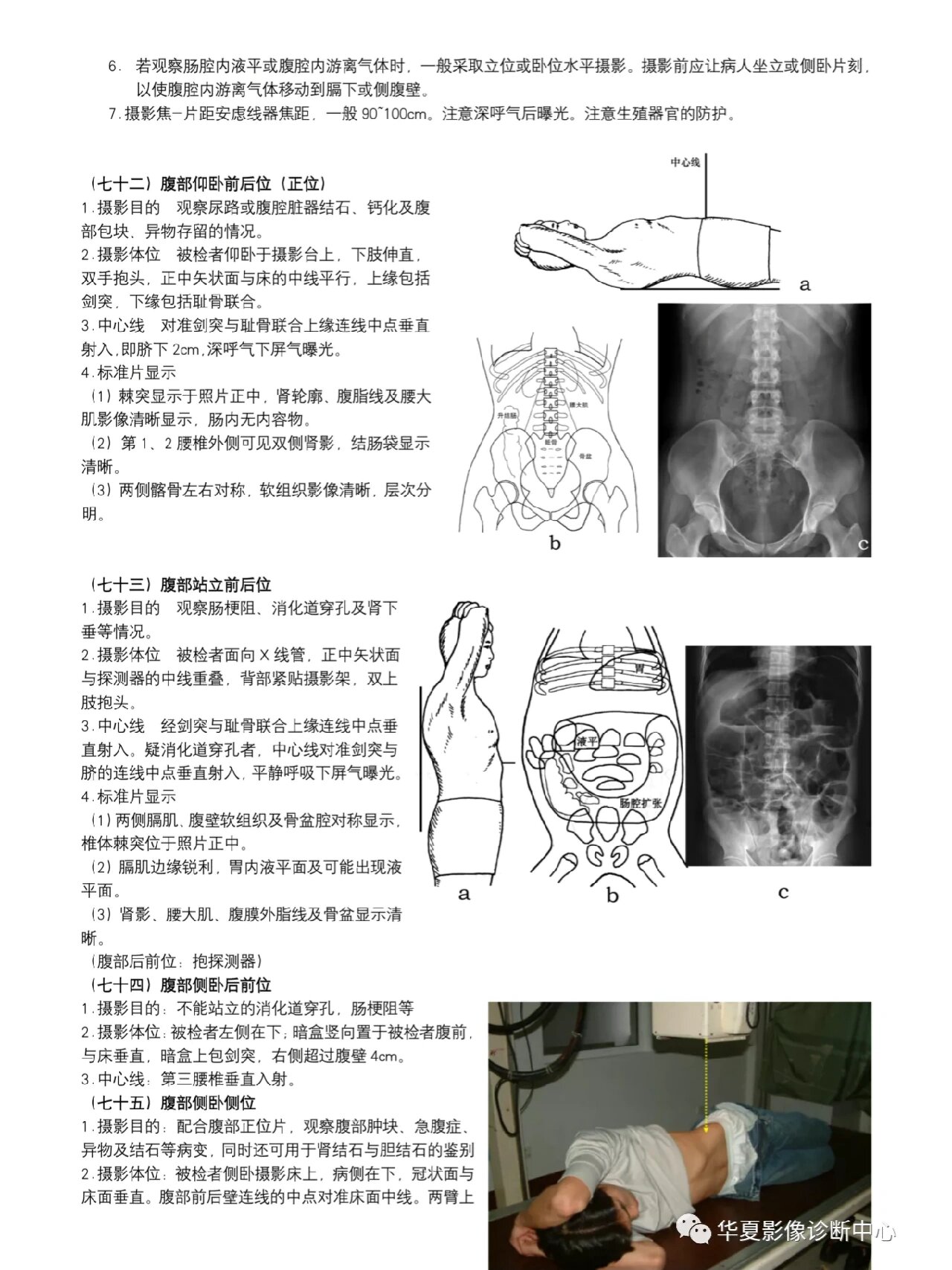 闭孔斜位投照图解图片