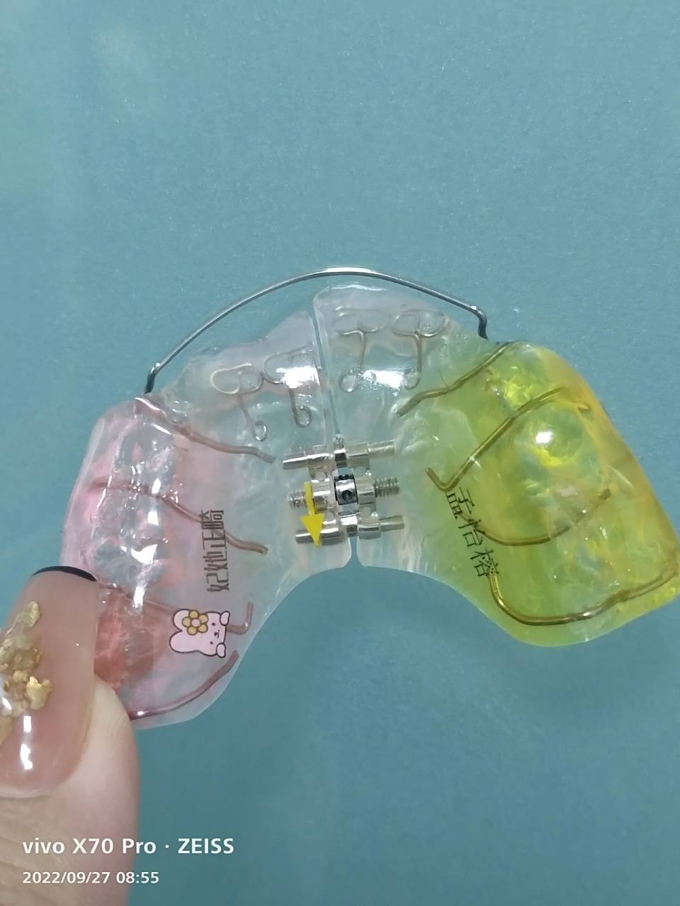 1.扩弓器两天加力一次,沿箭头方向加力,一次90度,也就是四分之一圈.