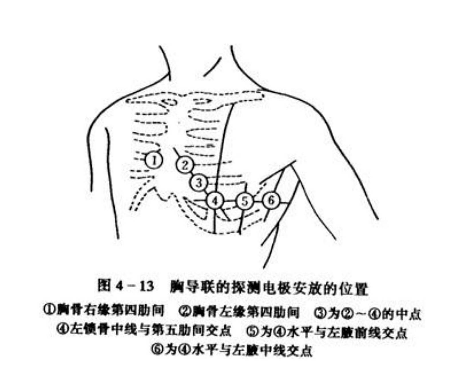 心电图电极安放位置及颜色对应