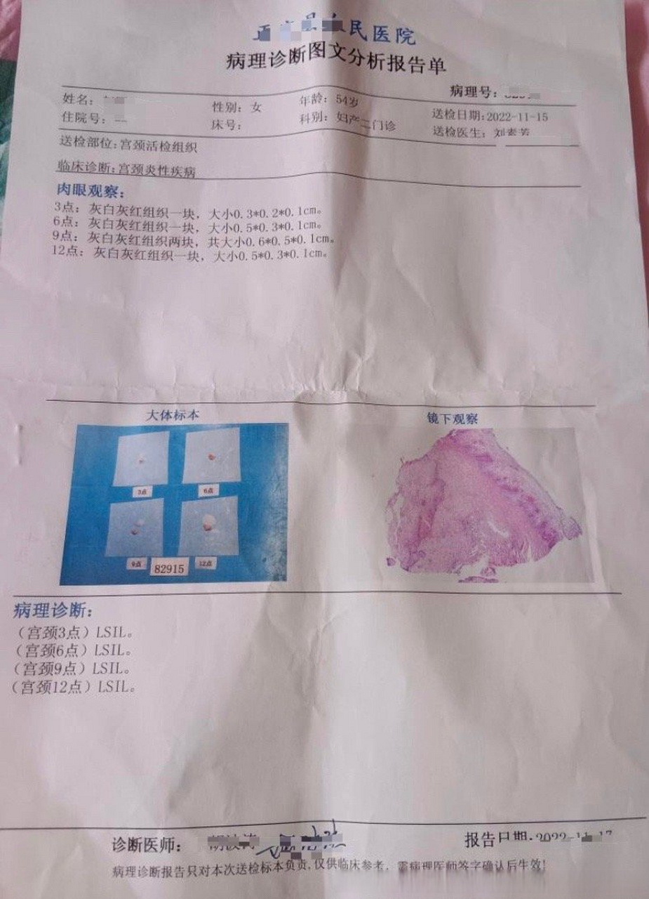 我hp∨39阳性,tct没事,问怎么治疗?