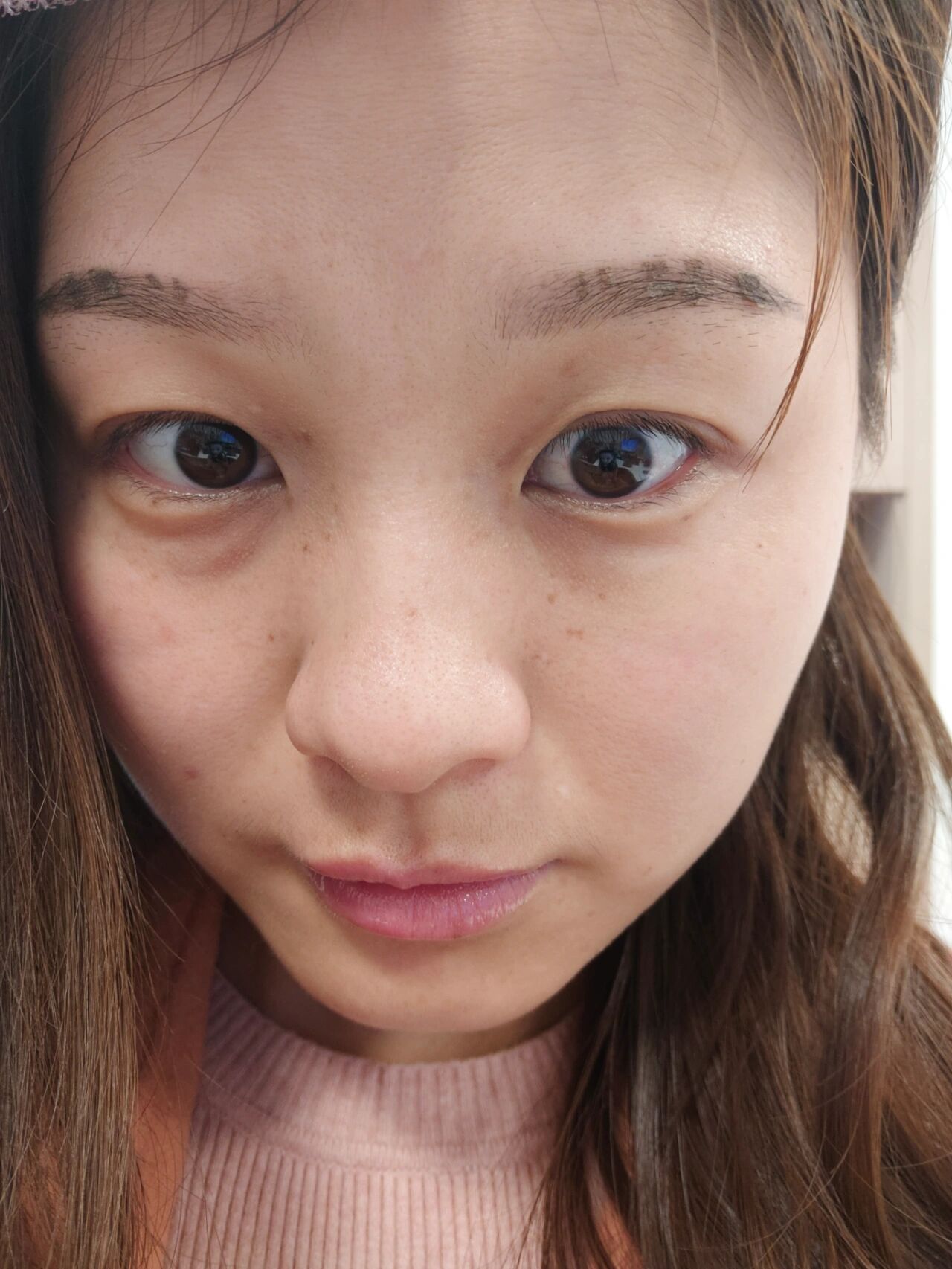 纹眉第八天,结痂脱落期