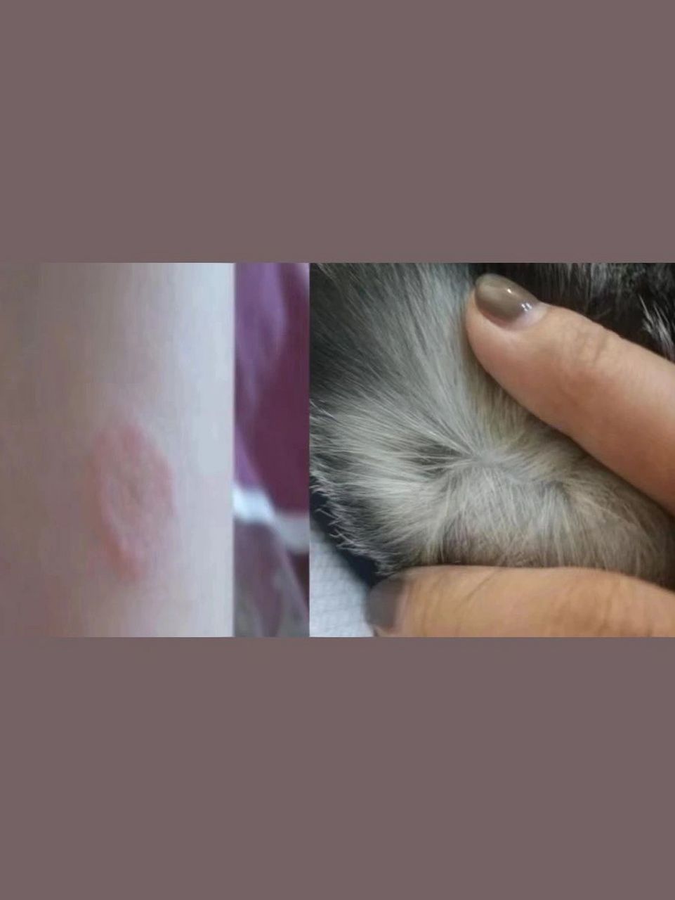 93猫癣传染了我……会自愈么?