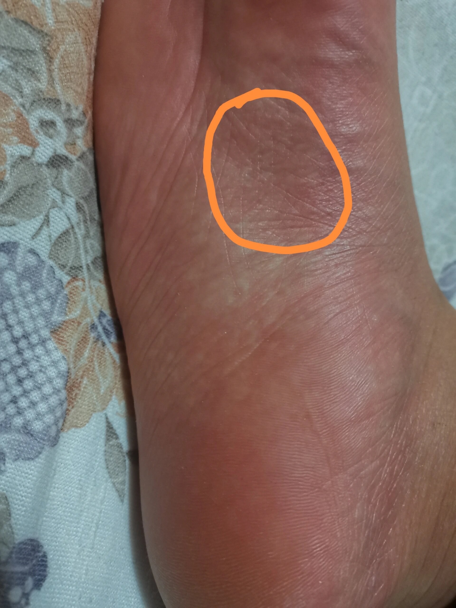 右脚底这个位置痒疼是怎么回事啊