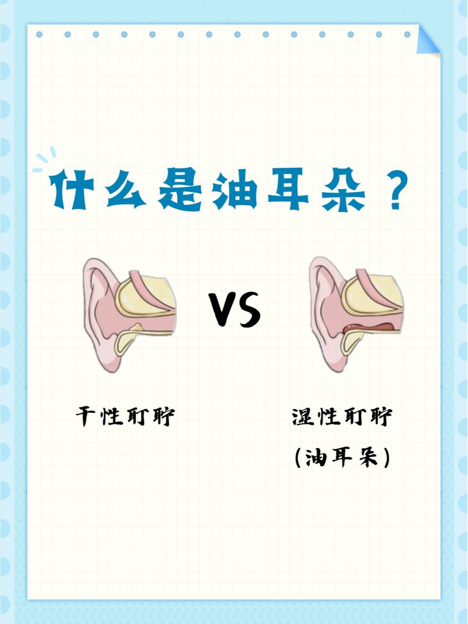 耳道结构耳屎位置图片图片