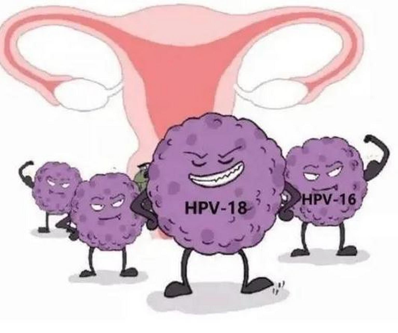 比如说hpv16和18型,如果不管不顾拖上一两年
