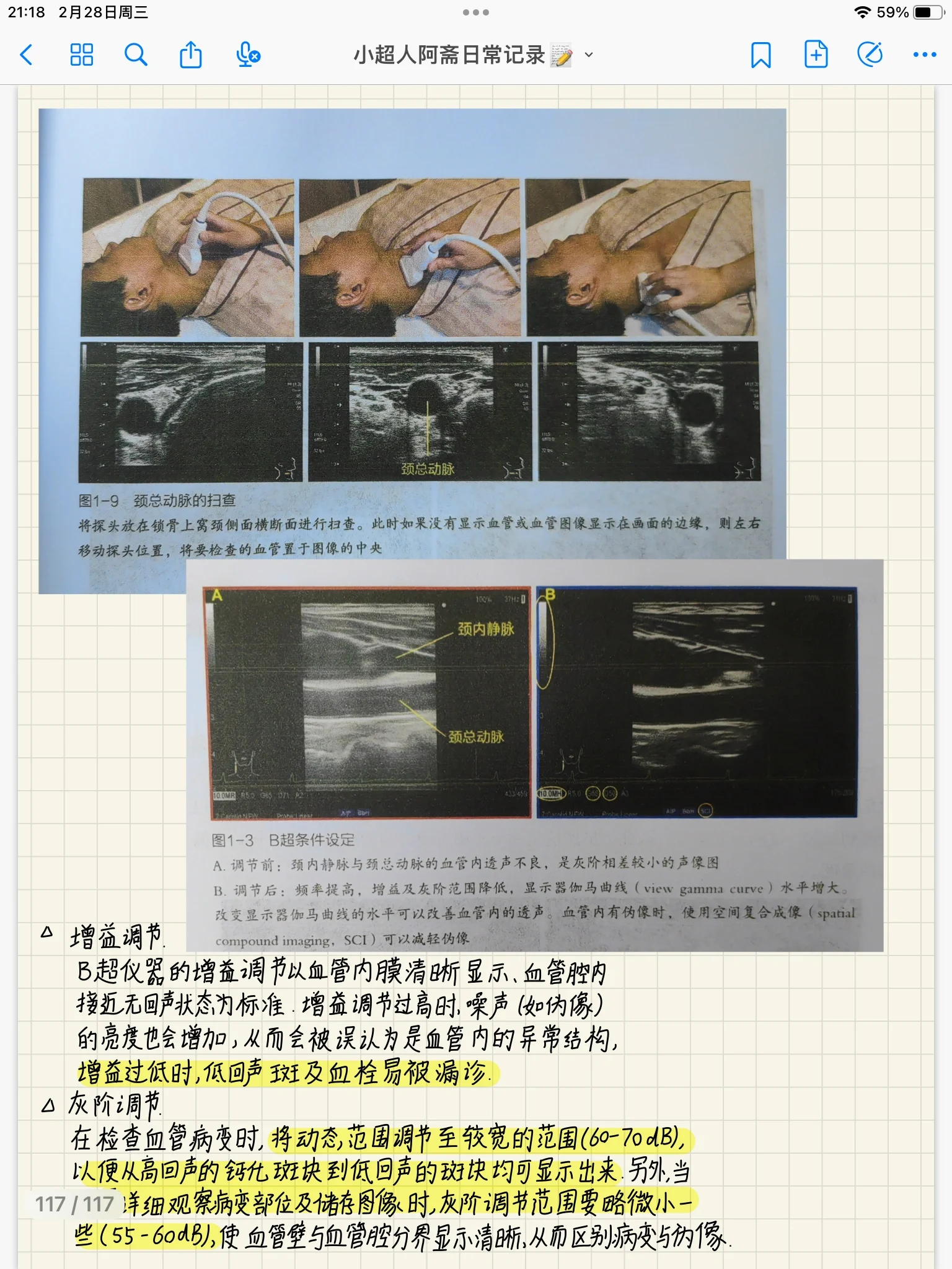 超声笔记:颈部血管怎么看?