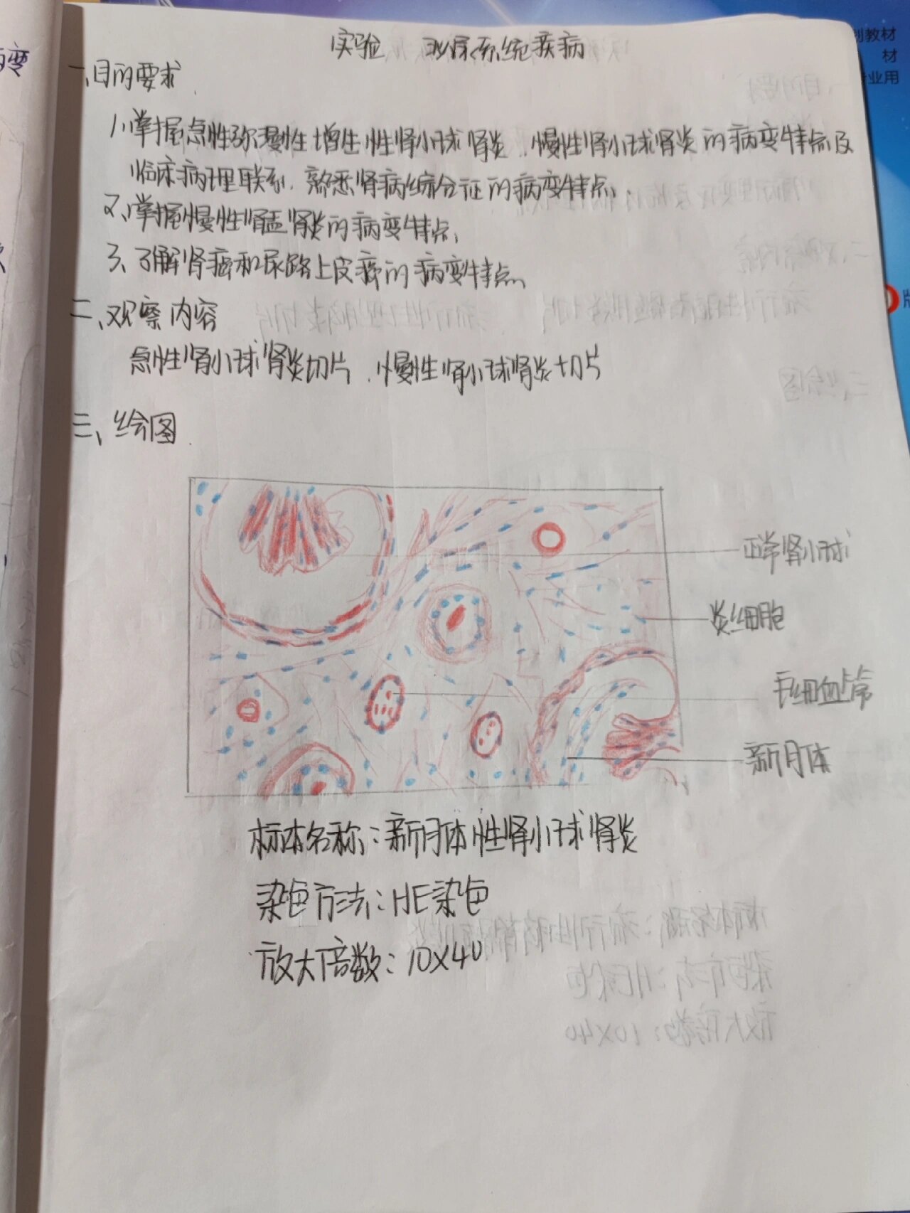 慢性肾炎红蓝铅笔绘图图片