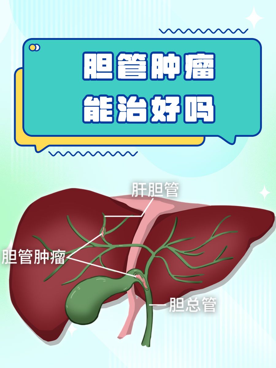 胆管癌的位置图片图片