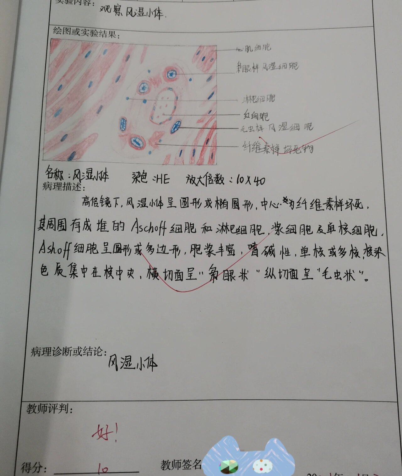 风湿小体