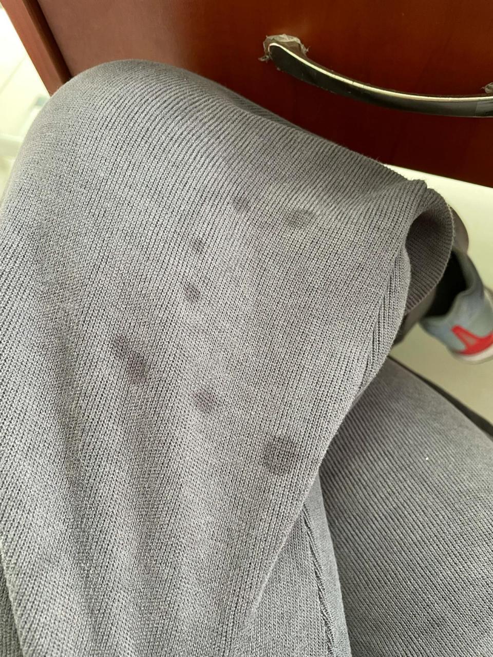 油点可怎么去 01 每条裤子每件衣服,随处可见的油点,都不知道怎么弄