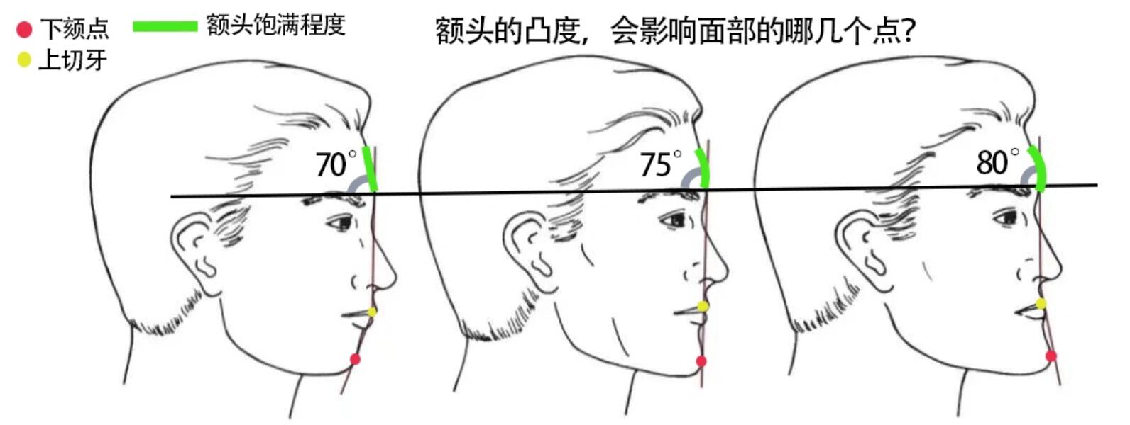 额头太凸怎么办图片