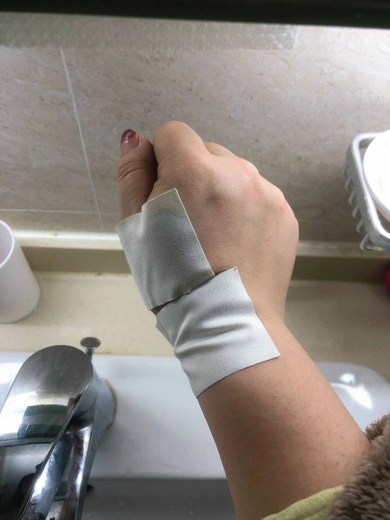 妈妈手 腱鞘炎 真的不要再去医院97了