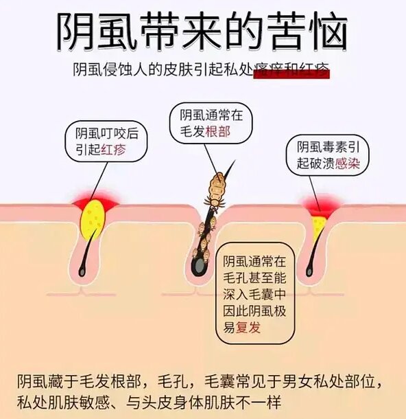 因为阴虱的体积比较小,一般雌性的阴虱成虫体长会在1