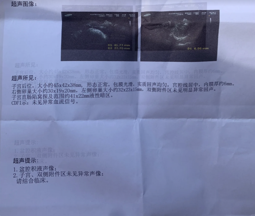 阴超能查出很多和妊娠相关的疾病,也能发现子宫及附件的其他问题