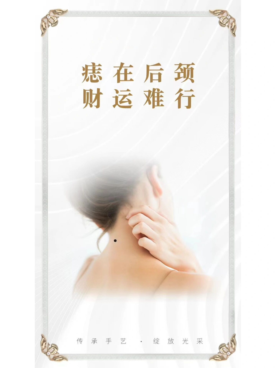 点掉不好的痣,让好运财