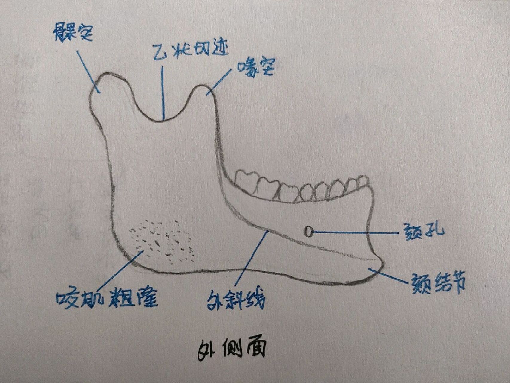 简画下颌骨,帮助我们更好的记忆. 下颌骨的薄弱部位包括正中联合,颏孔