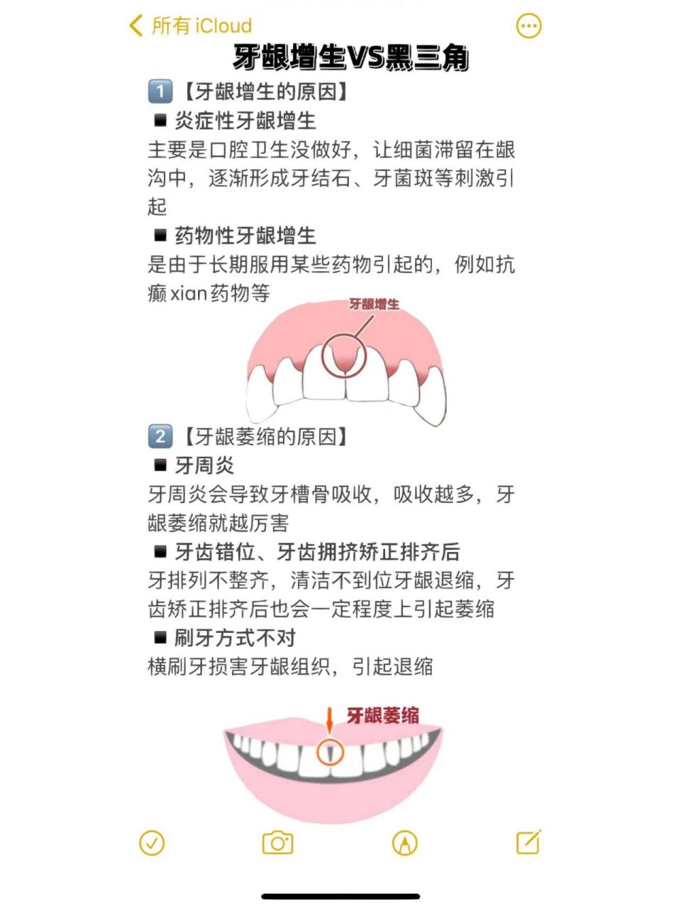自从戴牙套奇奇怪怪的名词增加了-牙龈增生 这次二次整牙,真的是增涨