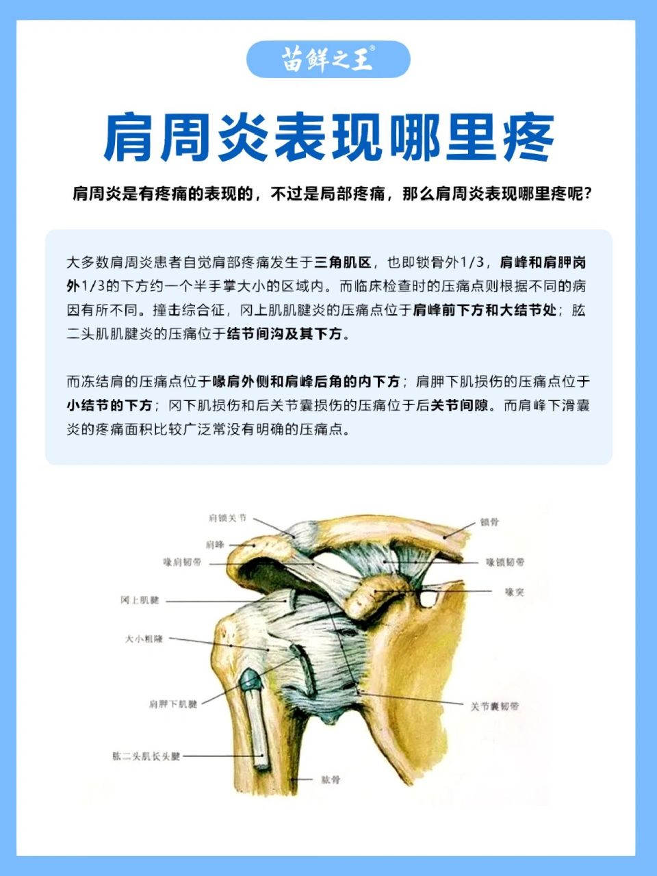 肩周炎哪里痛图片解析图片