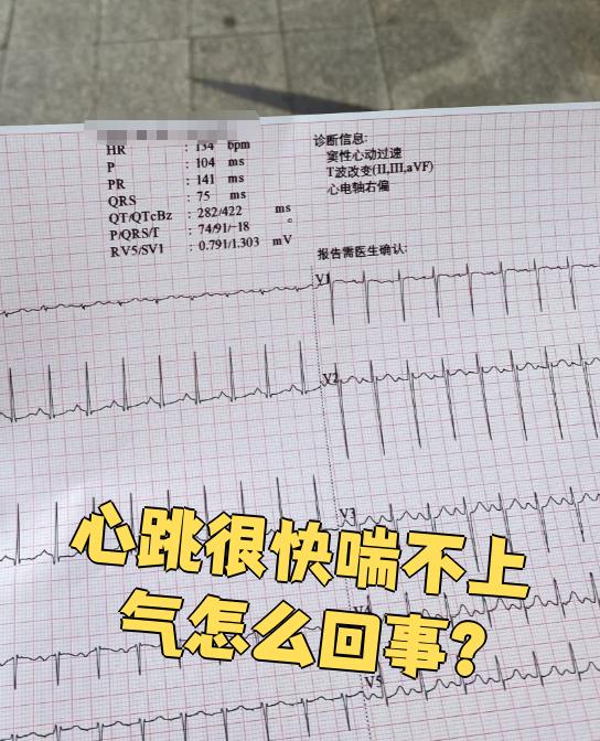 为什么心跳很快 为什么心跳很快