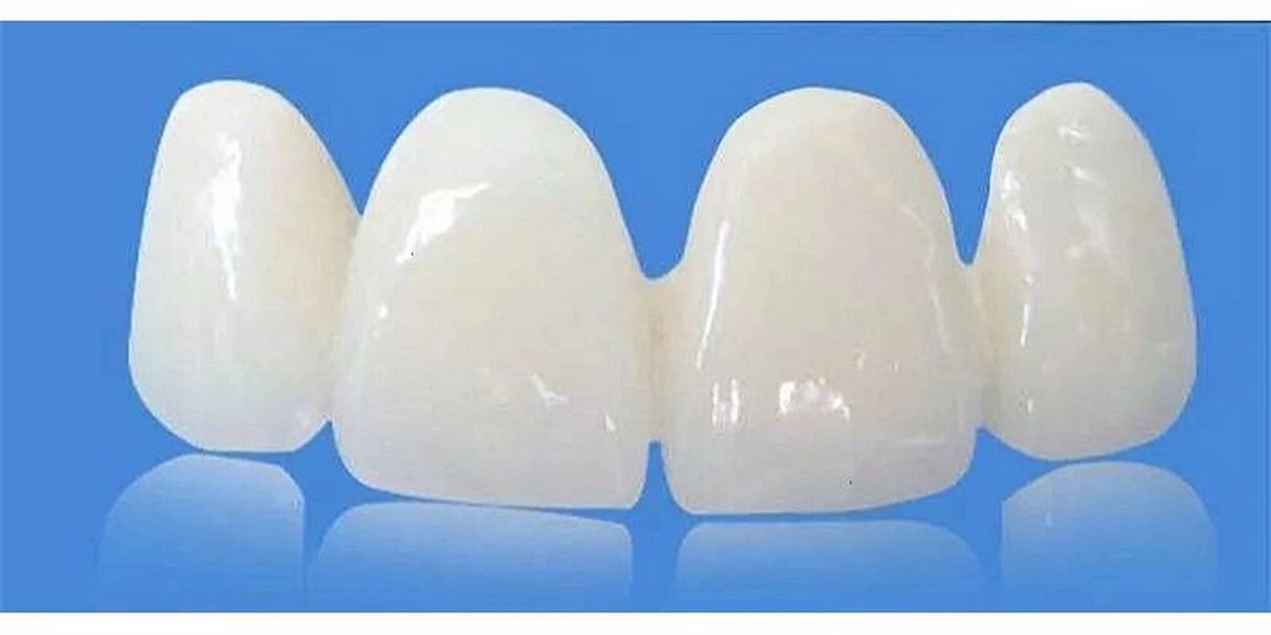 什么是二氧化锆全瓷牙,有什么特点?
