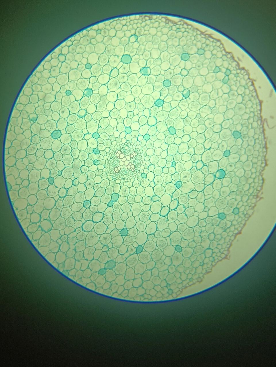 毛茛根横切切片观察 4倍  和  40倍 显微镜观察毛茛根横切永久切片