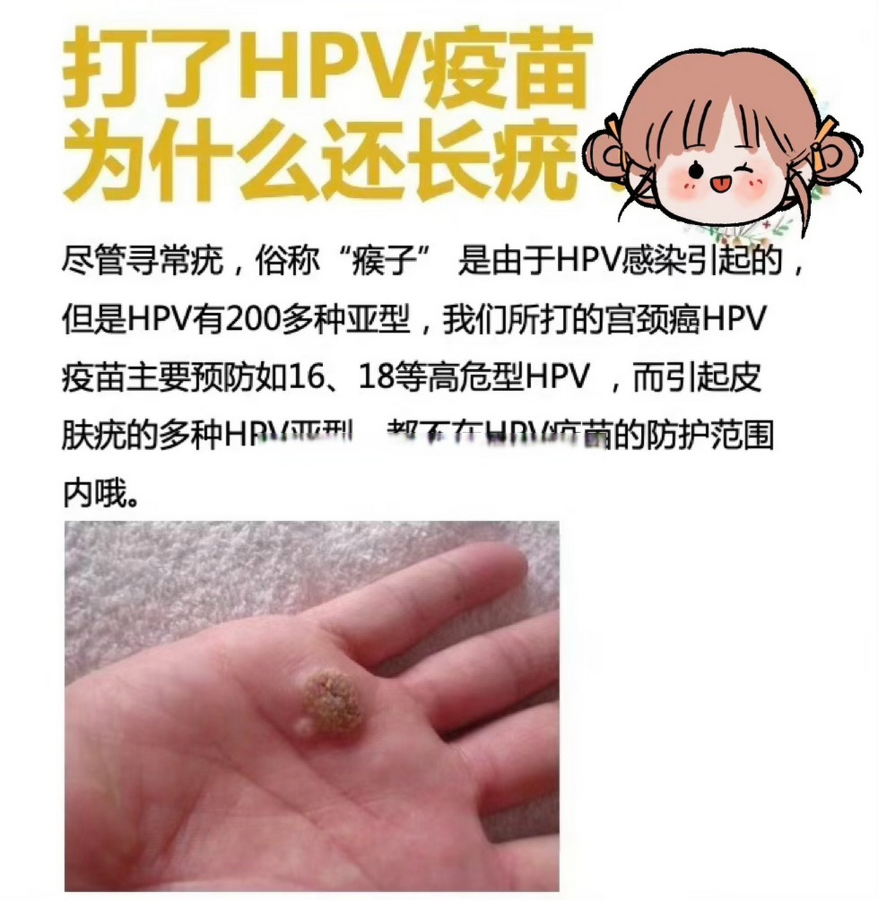 寻常疣,俗称"瘊子" 是由于hpv感染引起的,但是hpv有200多种亚型,我们