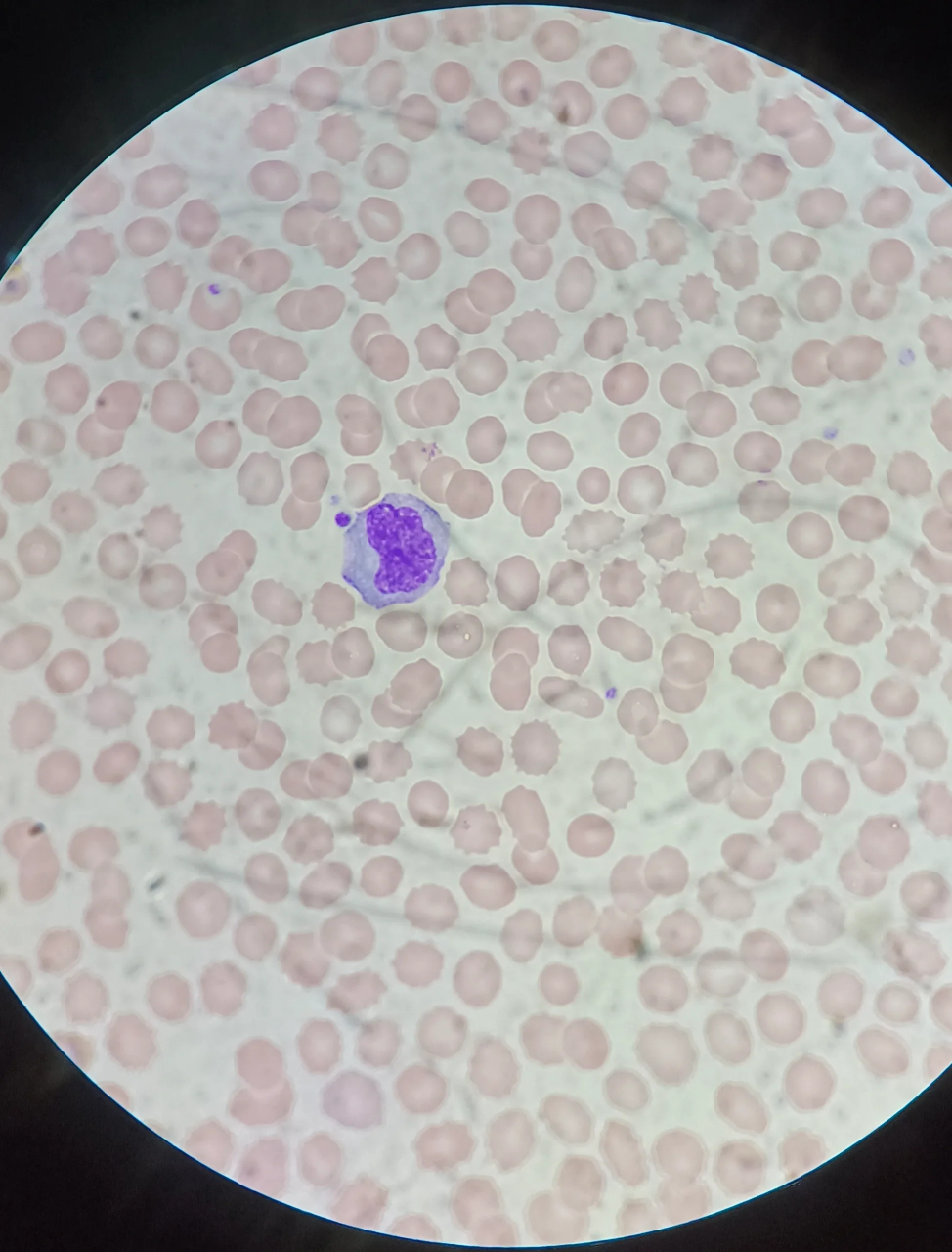 单核细胞 细胞较大,直径14～20um,呈圆形或卵圆形.