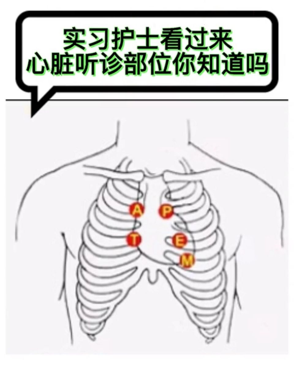实习临床护士看过来👉"心脏听诊区" 实习时心脏听诊部位你知道在