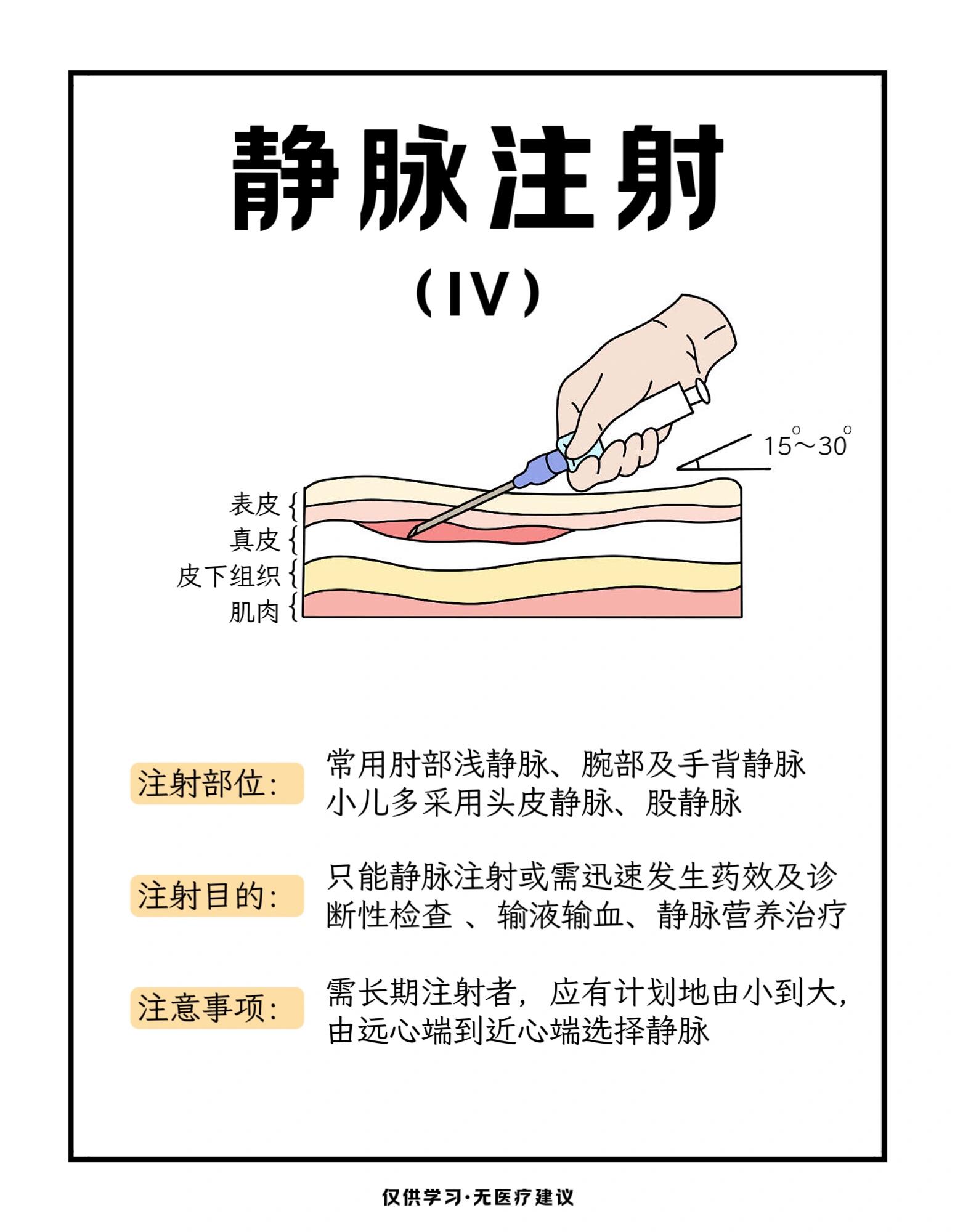 股静脉注射法图片图片