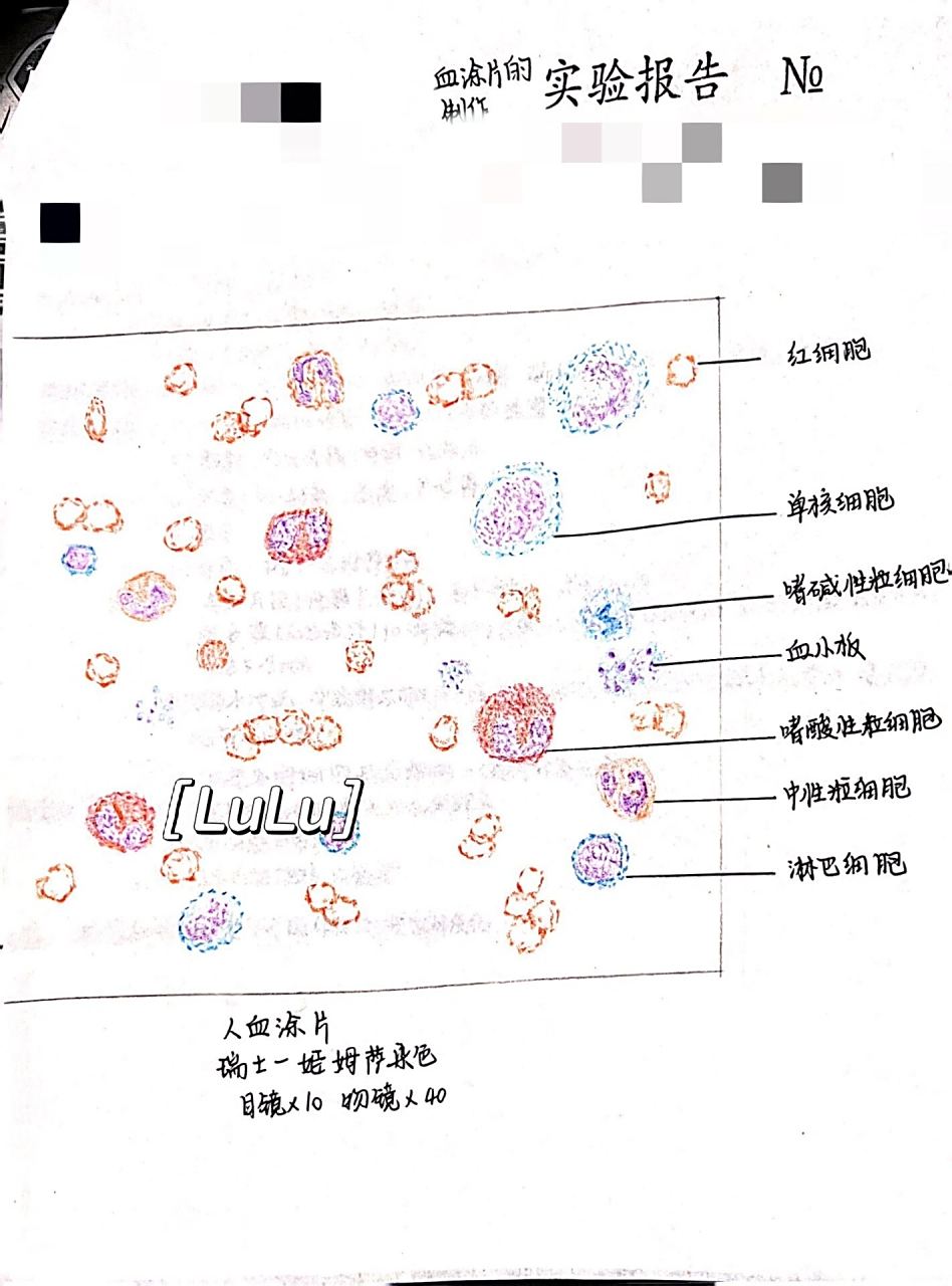 组胚实验报告:人血涂片的制作