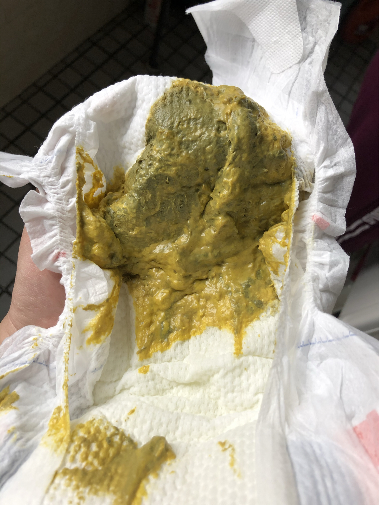 宝宝粑粑黄中带绿