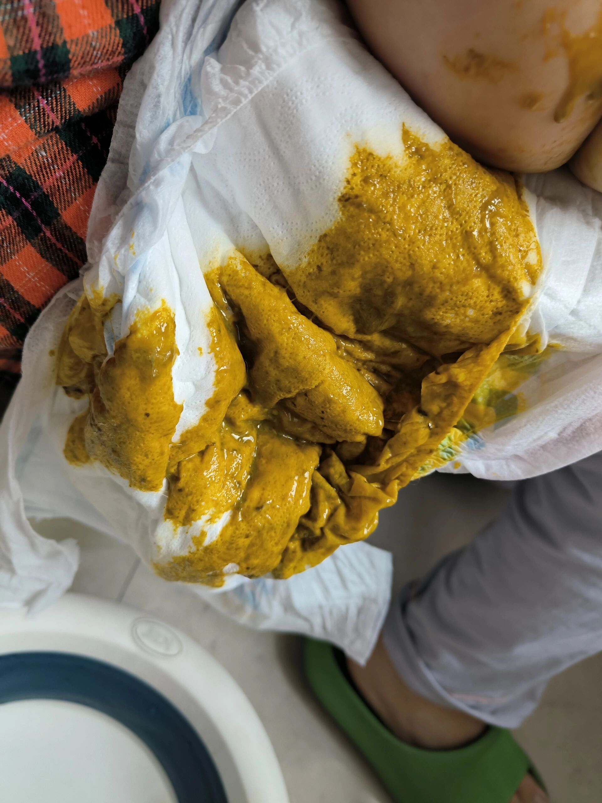 跪求帮忙宝宝稀便还排便困难