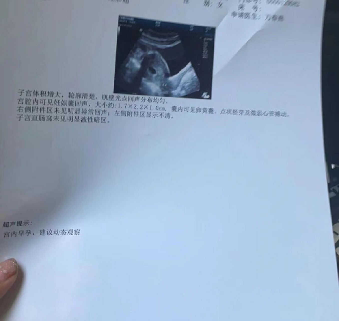 人流全部记录,无痛的 做这个人流我去的大医院做的,感觉会更有保障