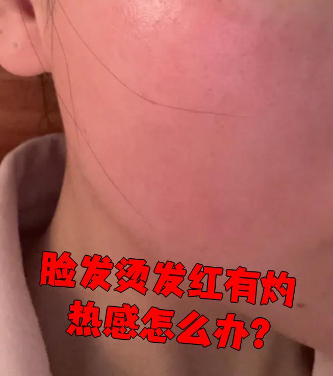 为什么脸发烫